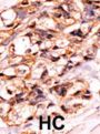Bad (pS118) Antibody