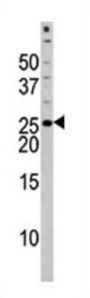 Bad (pS118) Antibody