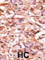 CDC25B (phospho-Ser187) Antibody