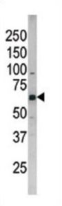 CDC25B (phospho-Ser187) Antibody