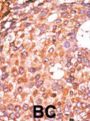 E2F1 (pS337) Antibody