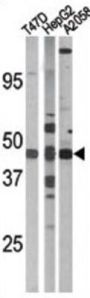 E2F1 (pS337) Antibody