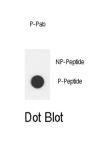 ErbB2 (pY1112) Antibody