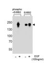 ErbB2 (pY1112) Antibody