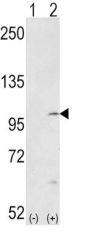 FGFR (phospho-Tyr653/654) Antibody