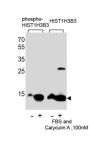 HIST1H3B3 (pS10) Antibody
