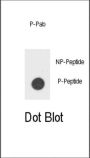 CSF2RB (pY766) Antibody