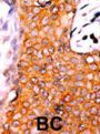 Methyl CpG Binding Protein 2 Phospho-Ser292 (MECP2 pS292) Antibody