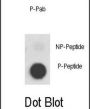 MET (pY1356) Antibody