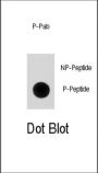 p21Cip1 (pS130) Antibody