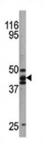 p53 (pS20) Antibody