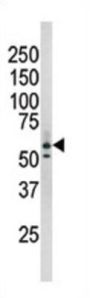 RAD9 (phospho-Ser277) Antibody