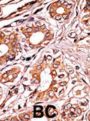 Rb (pS249) Antibody