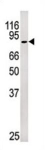 Rb (pS249) Antibody