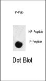 SMAD3 (pS208) Antibody