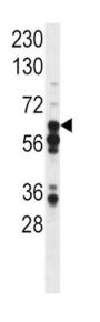 Signal Transducer and Activator of Transcription 3 Phospho-Tyr705 (STAT3 pY705) Antibody