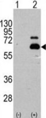 Ribosomal Protein S6 Kinase Beta-1 (S6K) Antibody