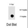 RAF1 (pS296) Antibody