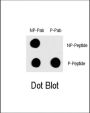 Proto-Oncogene C-Fos (pT232) (FOS) Antibody