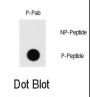 Myocyte-Specific Enhancer Factor 2C Phospho-Thr20 (MEF2C pT20) Antibody
