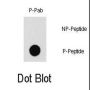 PAK1 (pT212) Antibody
