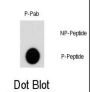 RAC-Beta Serine/Threonine-Protein Kinase Phospho-Ser474 (AKT2 pS474) Antibody