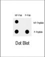 MAP3K7 (pS192) Antibody