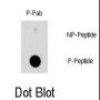 HSPB1 (pS78) Antibody
