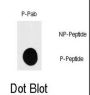 RPS6KB1 (pS418) Antibody
