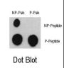 ATF2 (pS322) Antibody