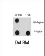 EGFR (pY1125) Antibody