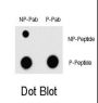 Myocyte-Specific Enhancer Factor 2C Phospho-Thr300 (MEF2C pT300) Antibody