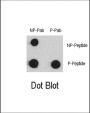 Myocyte-Specific Enhancer Factor 2C Phospho-Ser387 (MEF2C pS387) Antibody