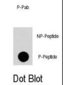 RGS19 (pS24) Antibody