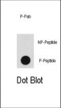 B-Raf Proto Oncogene Serine/Threonine Protein Kinase Phospho-Thr598 (BRAF pT598) Antibody