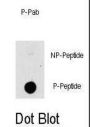 MAP3K8 (pT290) Antibody