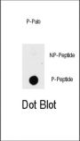 PAK1 (pT423) Antibody
