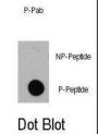 EIF4EBP1 (pT36) Antibody