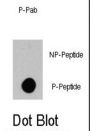 B-Raf Proto Oncogene Serine/Threonine Protein Kinase Phospho-Ser445 (BRAF pS445) Antibody