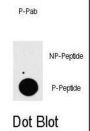 MAP3K7IP1 (pS423) Antibody