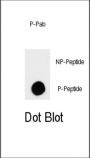 TSC2 (pS664) Antibody