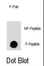 RAF1 (pS259) Antibody