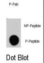 RAF1 (pY340) Antibody