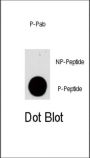 PIK3CG (pS1100) Antibody