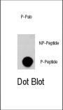 AKT3 (pS472) Antibody