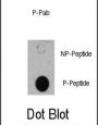 TSC1 (pS505) Antibody