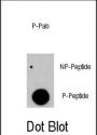 RAF1 (pY341) Antibody