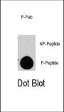 TSC2 (pS1798) Antibody
