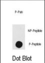 DNA-Dependent Protein Kinase Catalytic Subunit Phospho-Thr2609 (PRKDC pT2609) Antibody