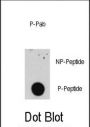 E2F1 (pS332) Antibody